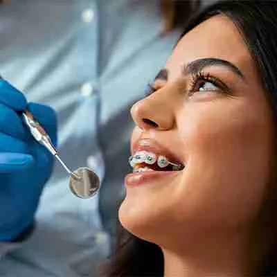 braces pyramid dental