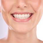 7 reasons you should get your teeth professionally whitened