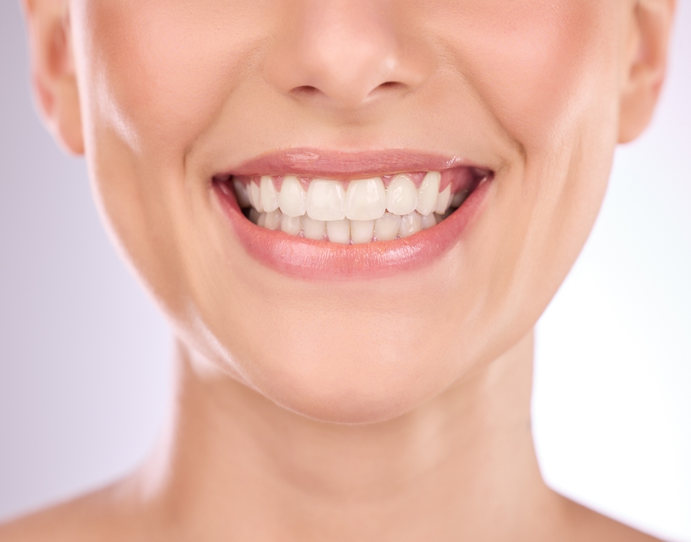 7 reasons you should get your teeth professionally whitened