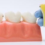 early signs of cavities in children and adults you should not ignore